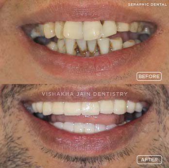sachin-bhawsar-3