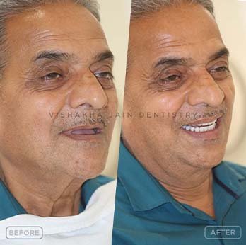 ANIL-LIMAYE-2