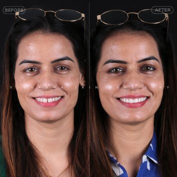 Smile Makeovers Tailored Just for You at Seraphic Dental